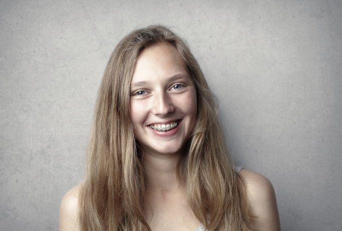 braces